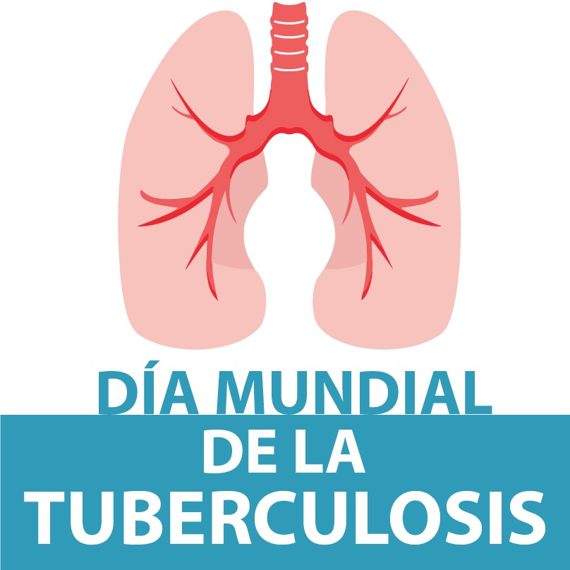 Tuberculosis: la detección temprana permite realizar el tratamiento y evitar la transmisión