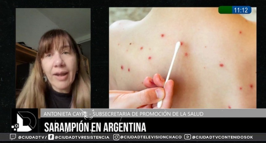 Recomiendan revisar esquemas de vacunaci&oacute;n ante brote de sarampi&oacute;n: &ldquo;Hay que estar en alerta permanente&rdquo;